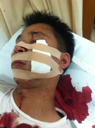 加多寶與廣藥再爆流血沖突 廣藥一員工慘遭毀容