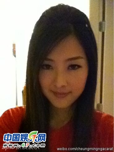 有人爆料指張名雅做過四次整形手術(shù)，還提供了一張疑似張名雅的舊照(左圖)