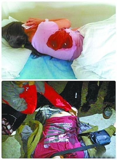 華山捅游客嫌犯未經(jīng)傷者辨認(rèn) 警方稱沒來得及