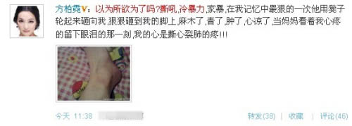 殘忍的明星家暴 太慘了！