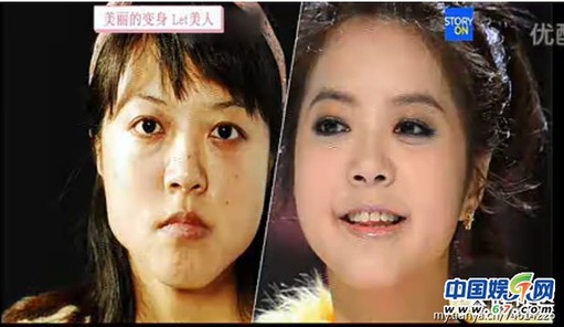 多圖劇透韓國整容節(jié)目《LET 美人》近幾期，最愛小V臉，人瘦就能美
