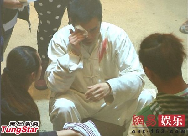 陳奕迅失足摔破睪丸成龍險喪命 盤點明星“悲催”受傷史