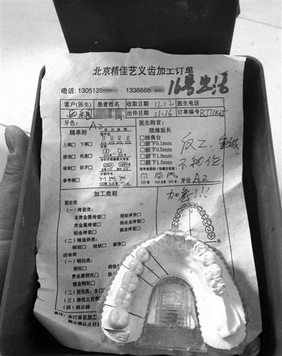 精佳藝義齒加工訂單顯示“反（返）工、重做”等字樣，一名骨干業(yè)務(wù)員說(shuō)，該廠產(chǎn)品返工率占兩成。