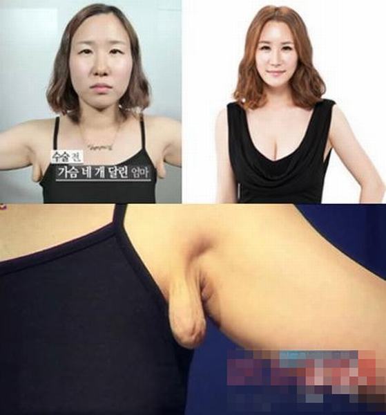 韓國《LET 美人2》整容節(jié)目前后對比驚人