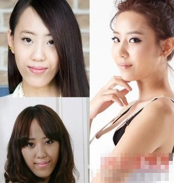 韓國《LET 美人2》整容節(jié)目前后對比驚人
