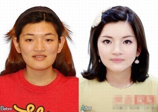 韓國《LET 美人2》整容節(jié)目前后對比驚人