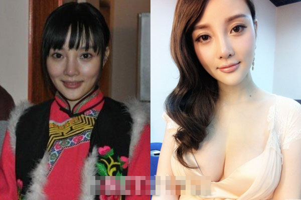 女星模樣越變越糟心:楊冪舍清純要巨乳 蕭薔變塑料臉