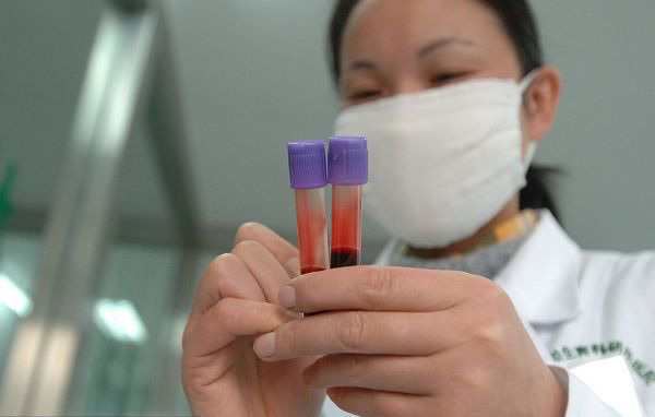 DNA親子鑒定全過程實拍