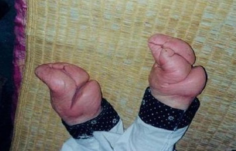 三寸金蓮背后的秘密：濃含性意識(shí)
