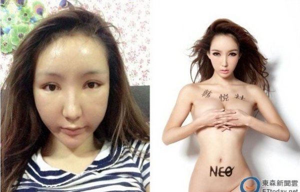內(nèi)地嫩模做處女膜修復(fù) 拆線腫臉問(wèn)可愛嗎